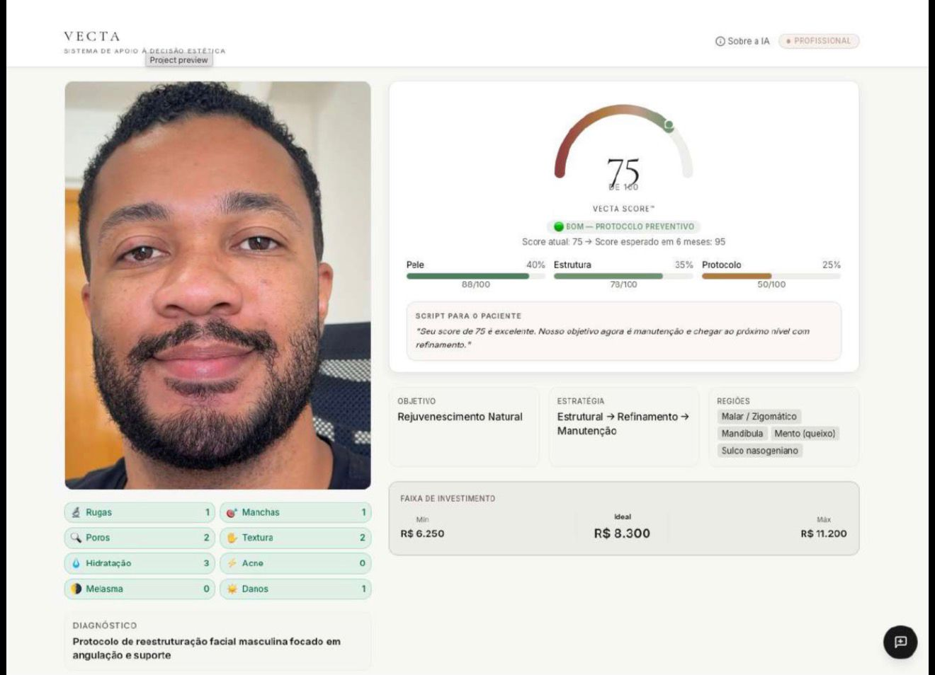 VECTA Score 75
